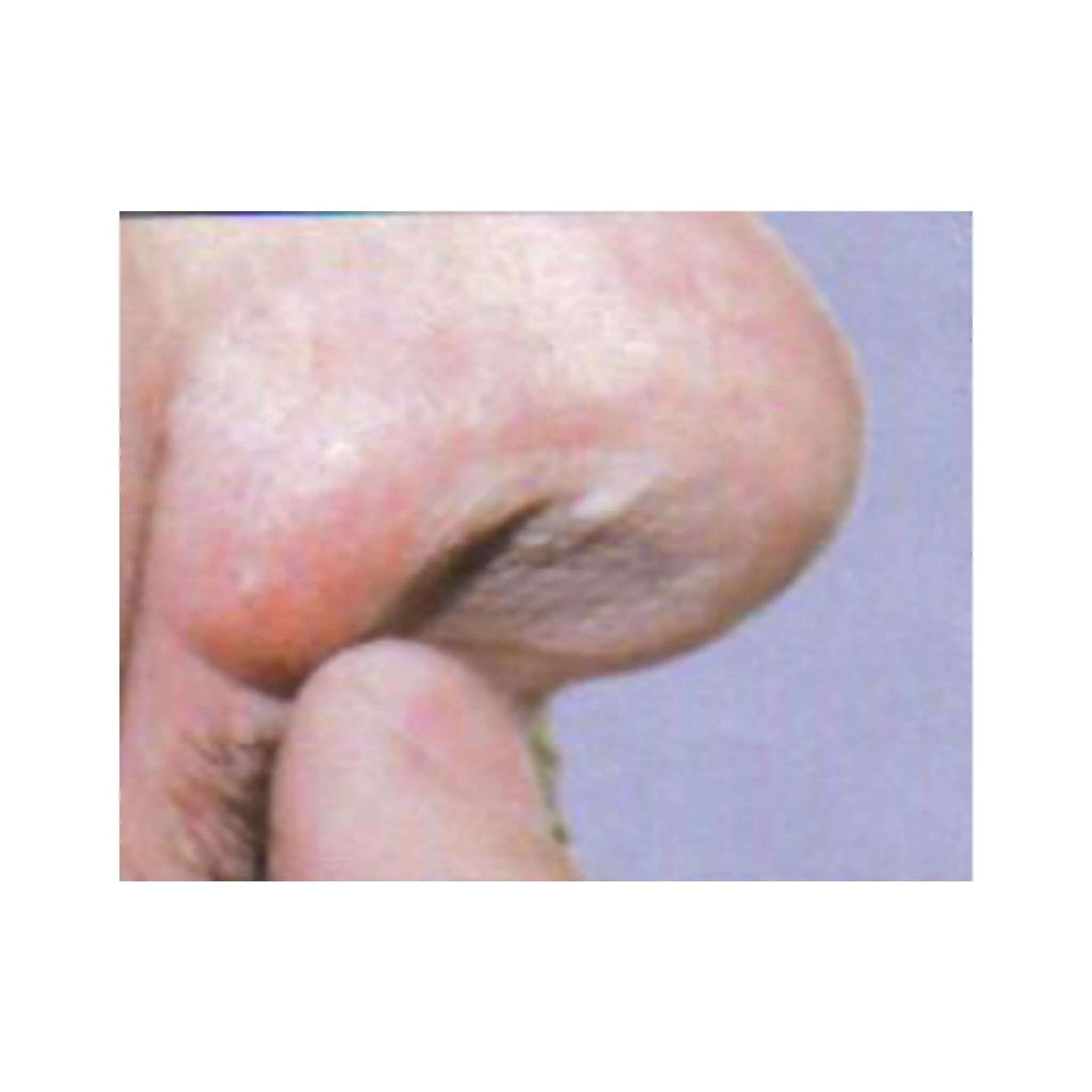 First Defense Nasal Screens