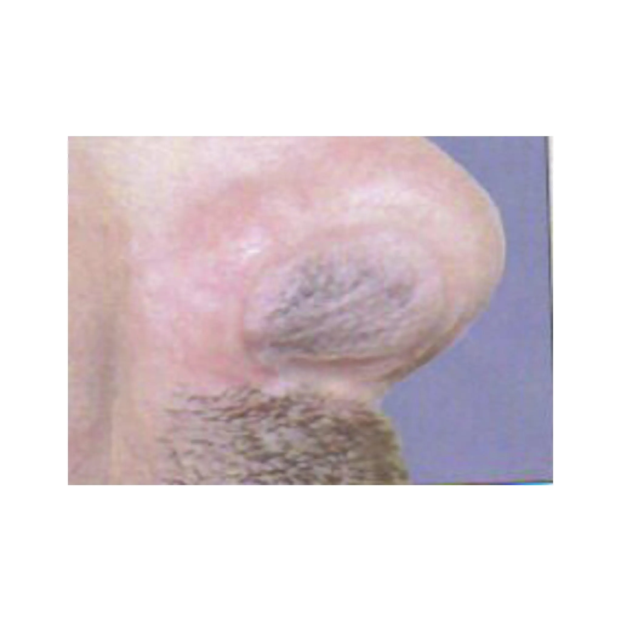 First Defense Nasal Screens